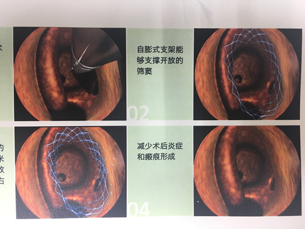 2017-07-11 154347.jpg