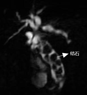 三改1.png 三改1.png