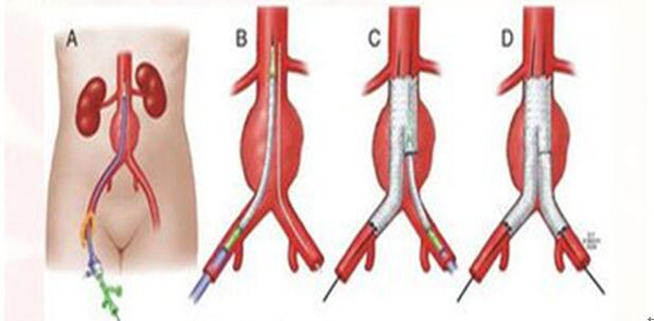 ssQQ截图20161104155935.jpg ssQQ截图20161104155935.jpg