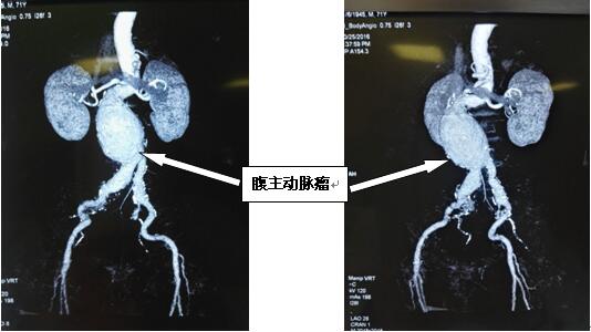 QQ截图20161104155902.jpg QQ截图20161104155902.jpg