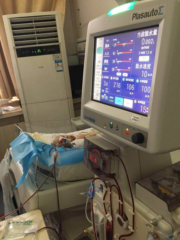 医生守候CRRT机旁确保运行平稳_副本.jpg