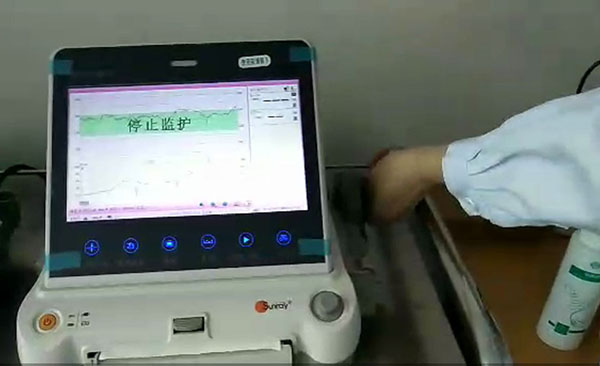 胎心监护操作视频.JPG 胎心监护操作视频.JPG
