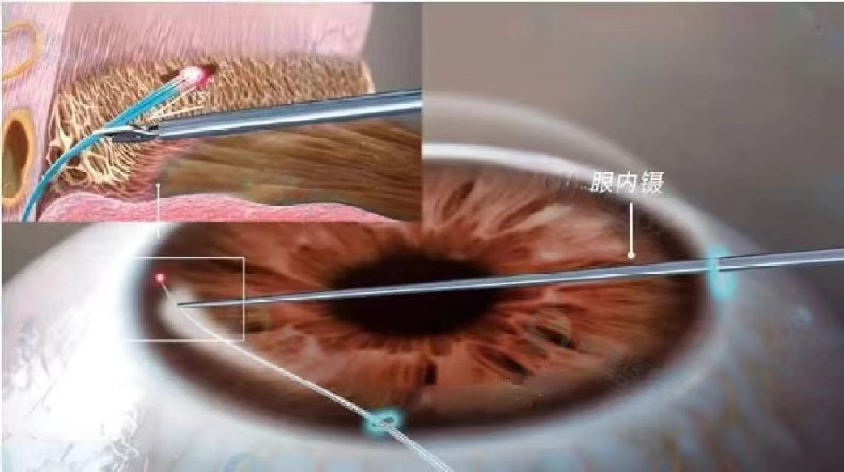 1c16da1344619437ec3ba94df1ddbe4.png 1c16da1344619437ec3ba94df1ddbe4.png