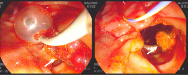 QQ截图20160725144528_编辑.jpg QQ截图20160725144528_编辑.jpg
