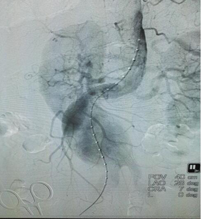 ssQQ截图20161104160020.jpg ssQQ截图20161104160020.jpg