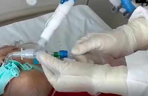 密闭吸痰操作视频.JPG 密闭吸痰操作视频.JPG