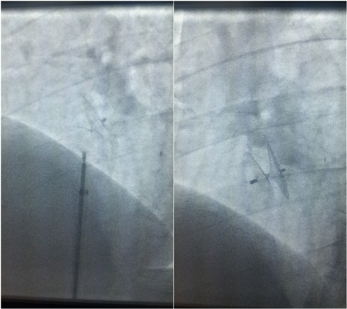 initpintu_副本.jpg initpintu_副本.jpg