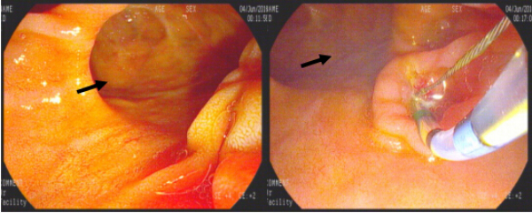 QQ截图20160725144001_编辑.jpg QQ截图20160725144001_编辑.jpg